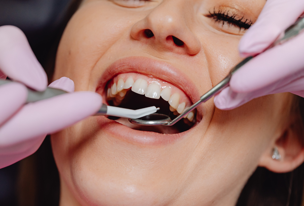 Dental Check Up