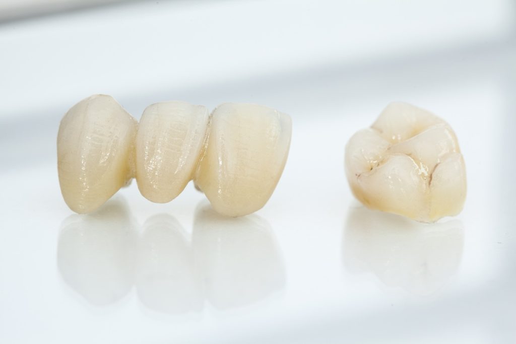 Zirconia crown and bridge model perfect for cracked tooth and missing tooth solutions in Mississauga.